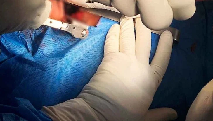 Hospital do Lubango realiza com êxito primeira cirurgia à coluna vertebral