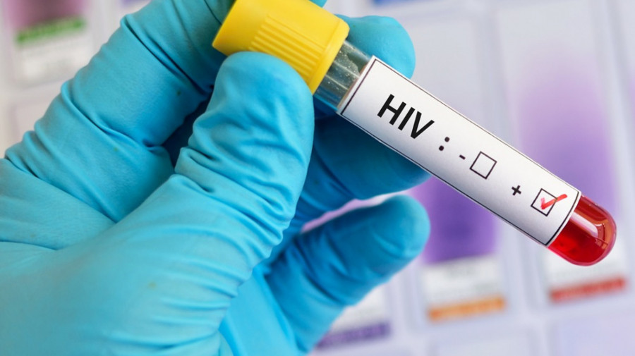 HIV/SIDA