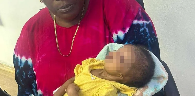 Criança de três meses nasce sem olhos, ouvidos e ânus em Cabinda
