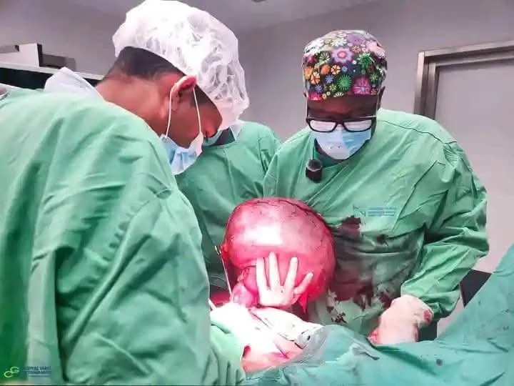 Paciente com tumor de 11,3 quilos operada no Hospital Geral do Cuanza-Norte