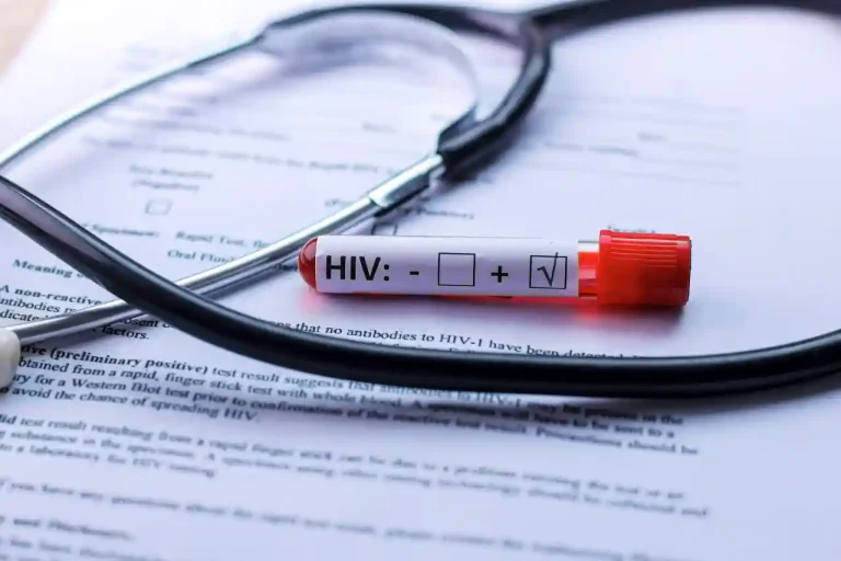 Dez por cento da população de Cacuso em Malanje vive com o VIH